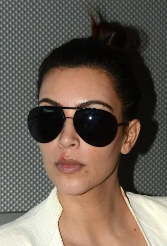 Kim Kardashian with cold sore above her lips