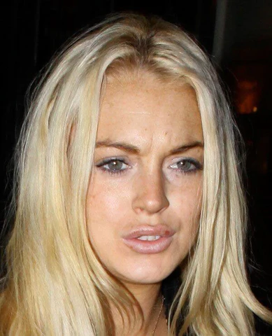 Lindsay Lohan with visible cold sore on upper lip