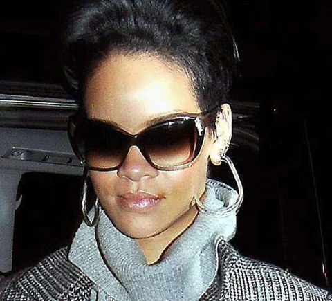 Singer Rihanna with cold sore